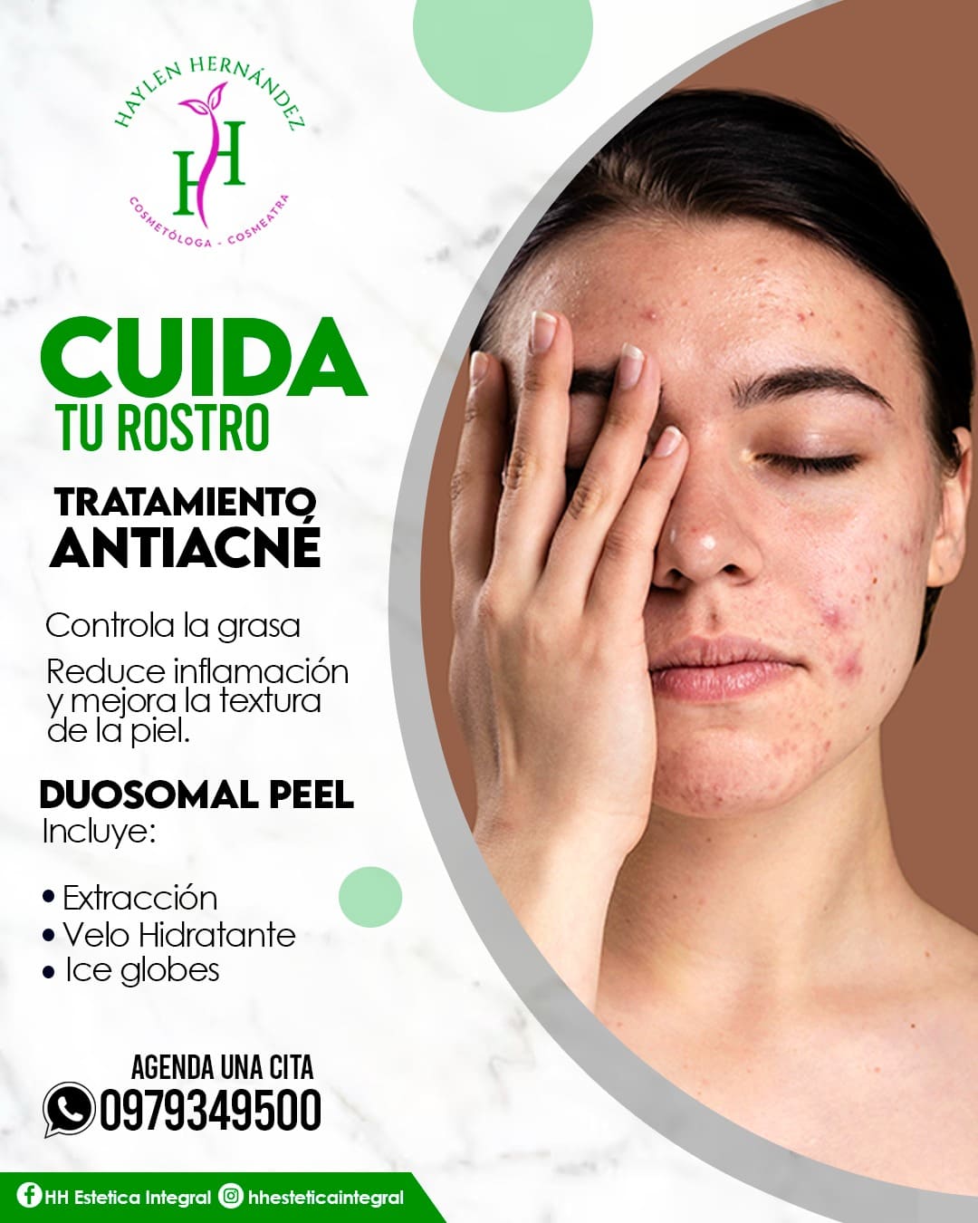 Tratamiento Antiacné